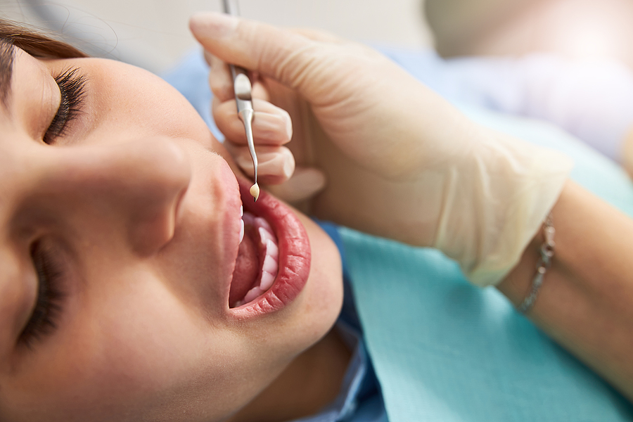 Do Dental Implants Feel Like Real Teeth? What You Need to Know